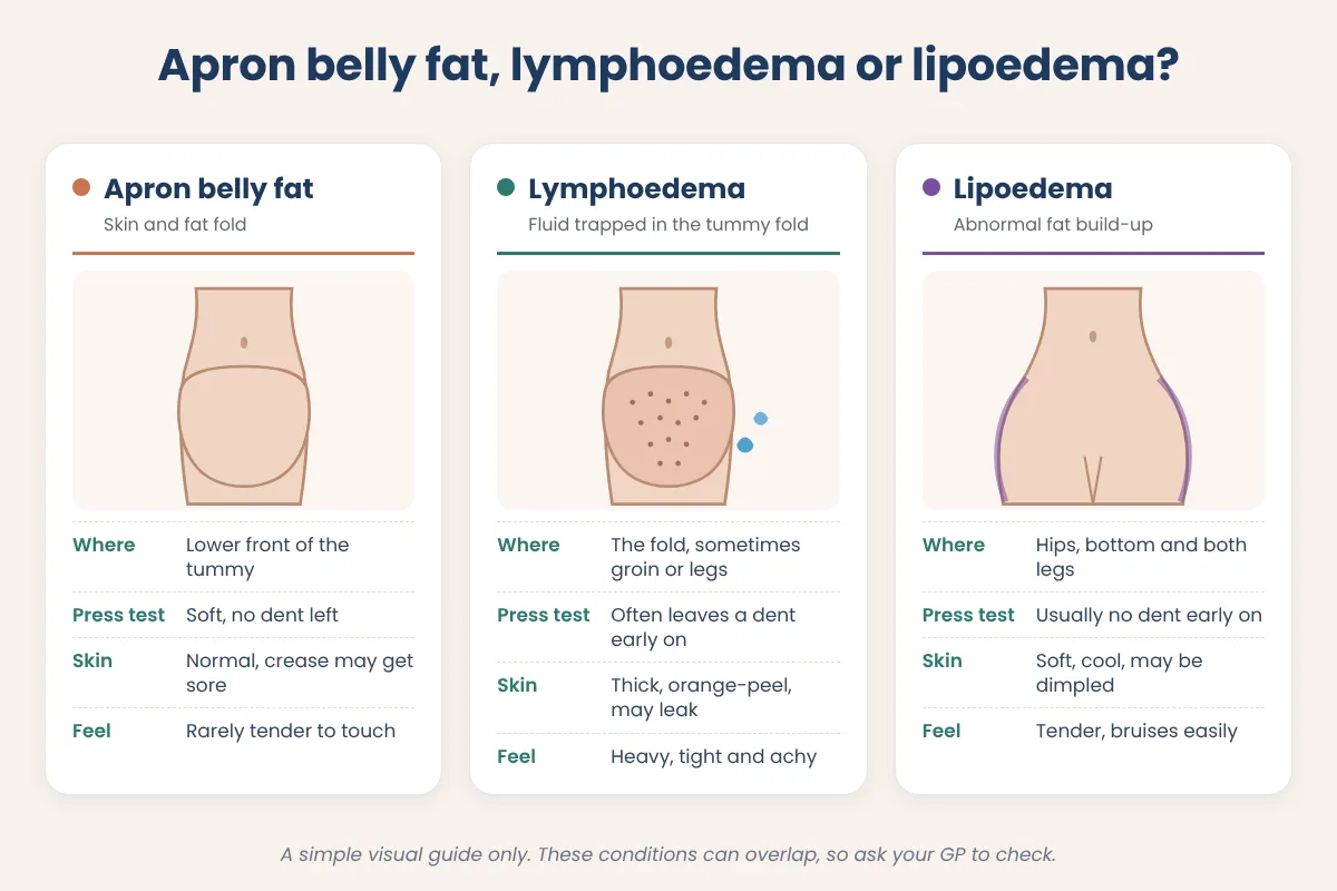Comparison diagram of apron belly fat, abdominal lymphoedema and lipoedema showing where each sits and how the skin feels