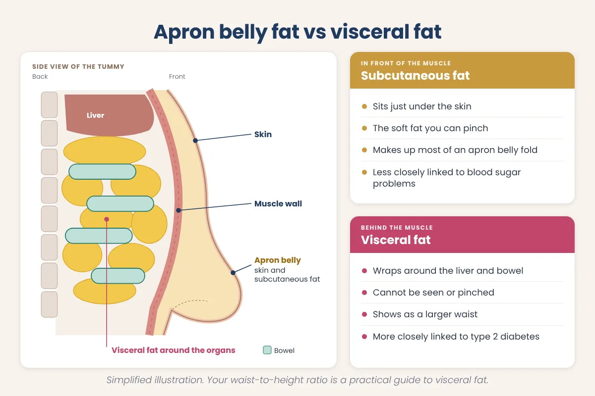 Cross-section diagram showing an apron belly fold of skin and subcutaneous fat in front of the muscle wall and visceral fat around the organs behind it