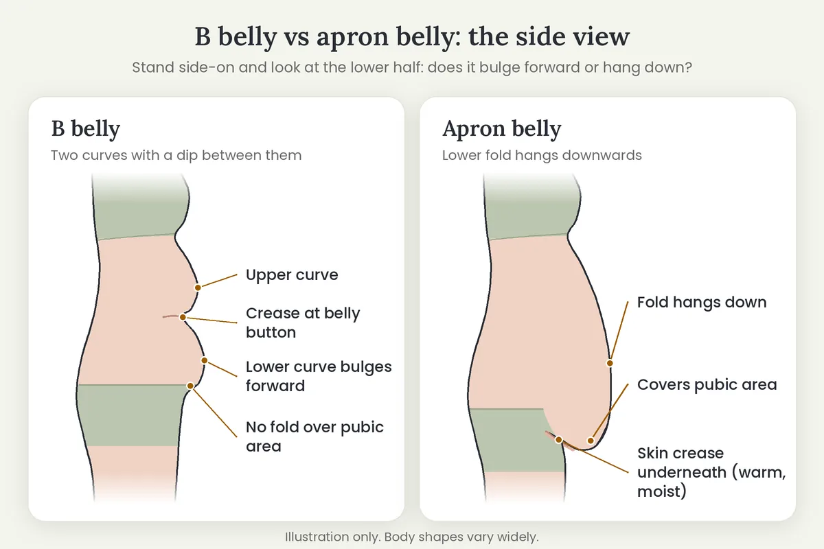 Side-profile diagram comparing a B belly with two curves and a crease against an apron belly fold hanging over the pubic area