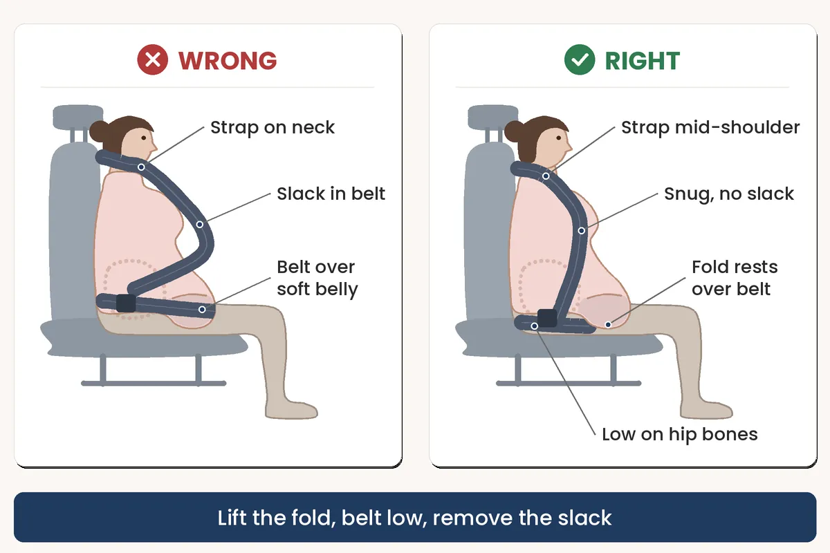 Side view diagram comparing a lap belt over the apron belly with a lap belt low on the hips