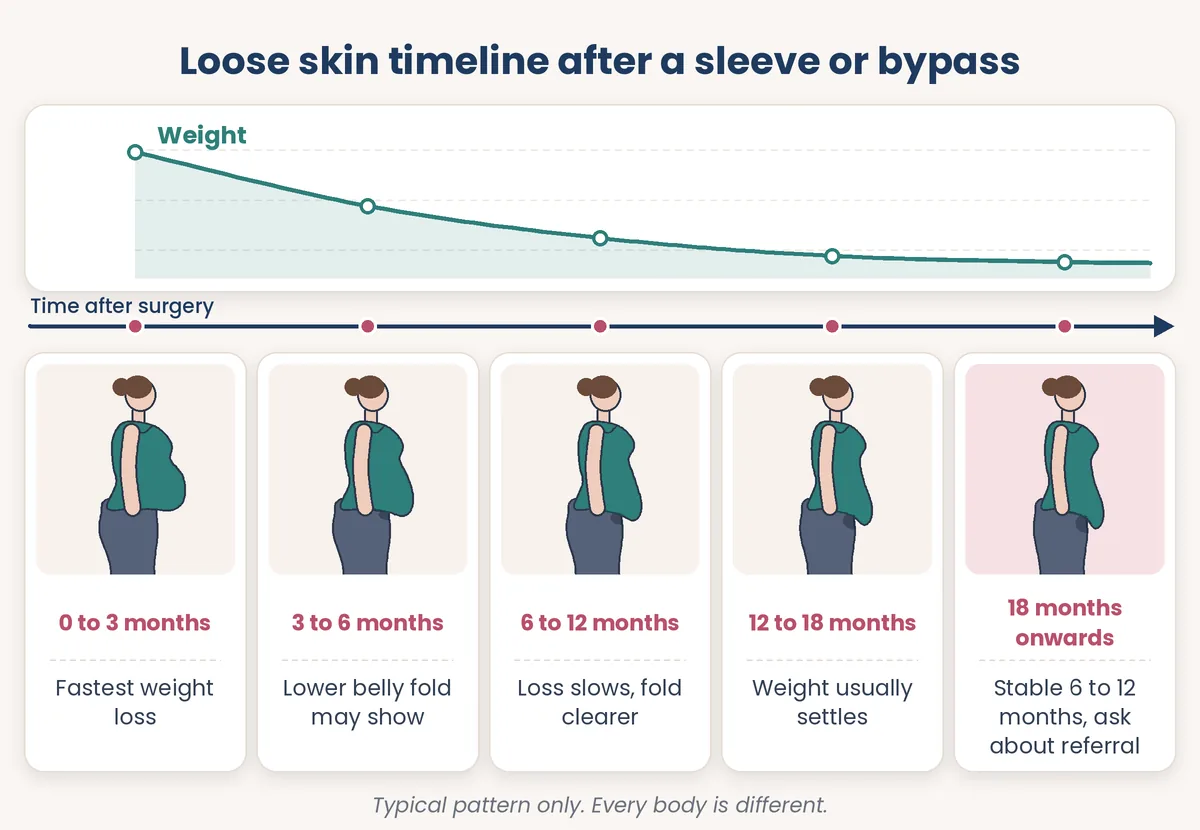 Timeline diagram of loose skin and weight changes in the first two years after gastric sleeve or bypass surgery